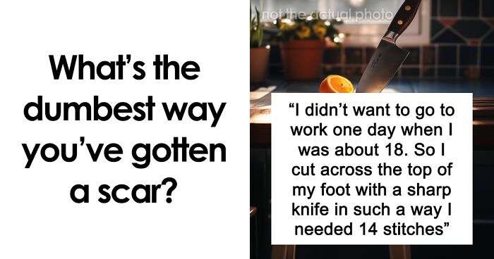 “Just To Prove I Was Tough”: Everyone Makes Mistakes, But These 47 People’s Stupid Injury Stories Hurt To Read