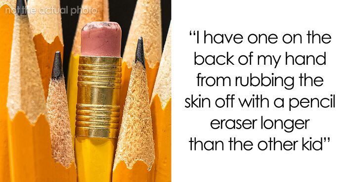 “Just To Prove I Was Tough”: Everyone Makes Mistakes, But These 47 People’s Stupid Injury Stories Hurt To Read