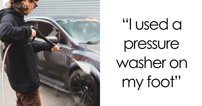 “Just To Prove I Was Tough”: Everyone Makes Mistakes, But These 47 People’s Stupid Injury Stories Hurt To Read