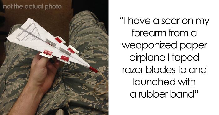 “Just To Prove I Was Tough”: Everyone Makes Mistakes, But These 47 People’s Stupid Injury Stories Hurt To Read