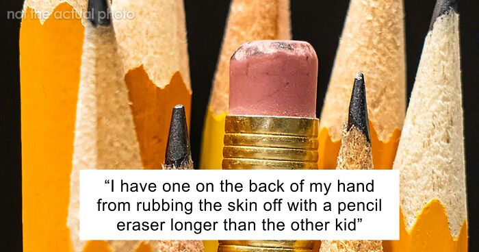 “Just To Prove I Was Tough”: Everyone Makes Mistakes, But These 47 People’s Stupid Injury Stories Hurt To Read