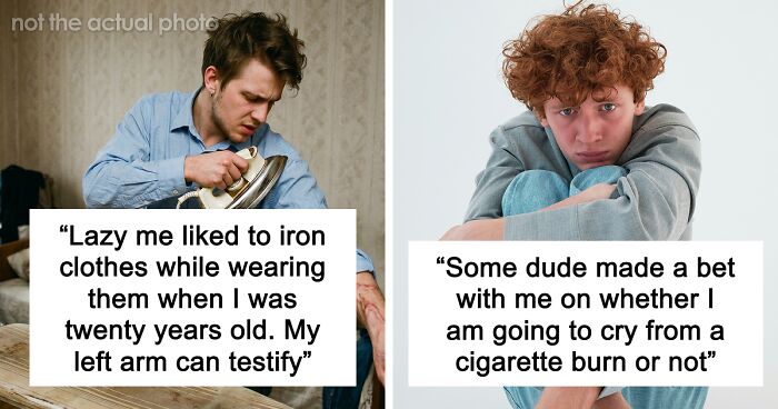 “Just To Prove I Was Tough”: Everyone Makes Mistakes, But These 47 People’s Stupid Injury Stories Hurt To Read