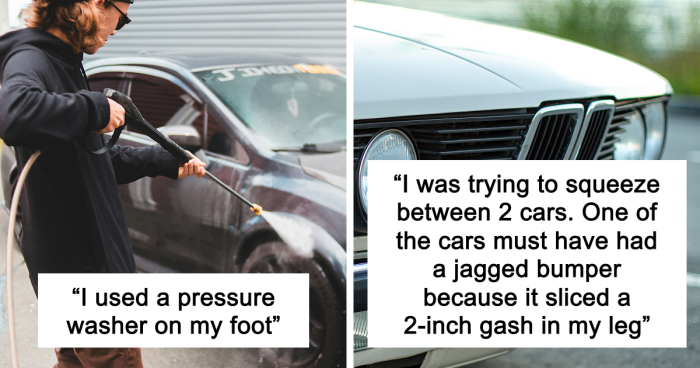 “Just To Prove I Was Tough”: Everyone Makes Mistakes, But These 47 People’s Stupid Injury Stories Hurt To Read