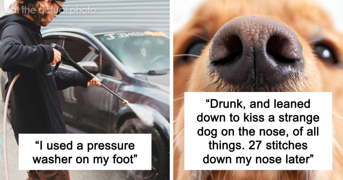 “Just To Prove I Was Tough”: Everyone Makes Mistakes, But These 47 People’s Stupid Injury Stories Hurt To Read