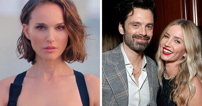 “Best Facial Harmonization I’ve Ever Seen”: 25 Before-And-Afters By A Plastic Surgeon Whose Work Went Viral