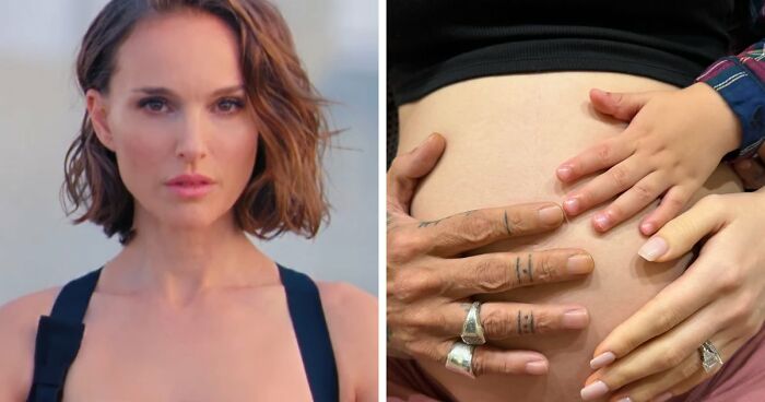 “Best Facial Harmonization I’ve Ever Seen”: 25 Before-And-Afters By A Plastic Surgeon Whose Work Went Viral