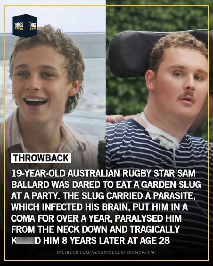 Before and after photos of Australian rugby star Sam Ballard who was paralyzed and died from a parasite infection after eating a garden slug.