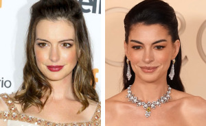 All The Signs Pointing To Your Coworker’s Secret Plastic Surgery, From Bat Ears To Bunny Nose And A Hairstyle Change