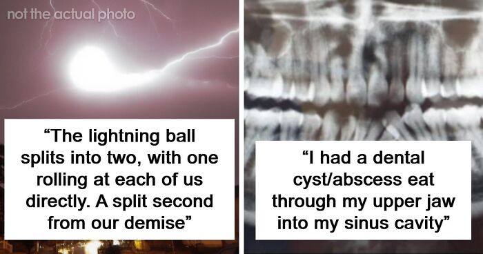 “Still Feels Fake”: 69 People Whose Stories Sound Made Up But Are 100% Real