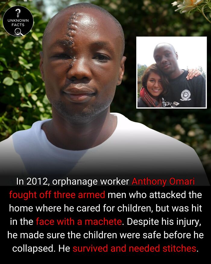 Anthony Omari, an orphanage worker, with a stitched face injury, revealing surprising interesting facts and his bravery.