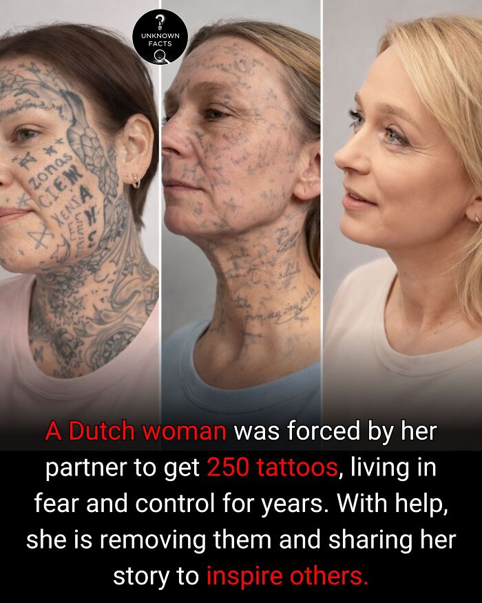 Three images of a woman showing her face and neck with many tattoos, then with fading tattoos, and finally with clear skin after tattoo removal. Interesting facts.
