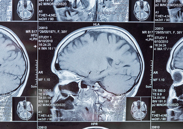 Close-up of brain MRI scans showing detailed cranial structures related to unproven scientific theories by top scientists.