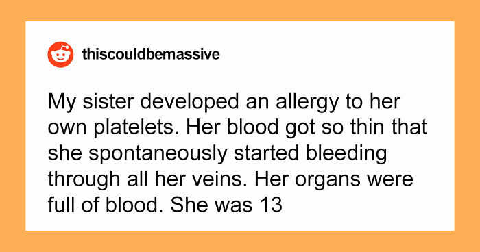 59 Times People Passed Away In The Most Unexpected And Bizarre Ways
