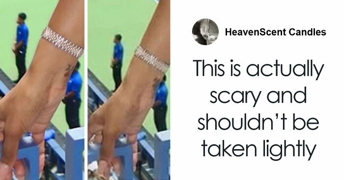 People Share 65 Photos Of The Unusual Things That Happened To Their Bodies