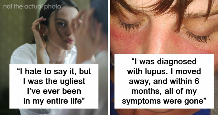 “I Was Literally Allergic To Him”: 71 Times People’s Bodies Literally Said “No” Before Their Hearts Did