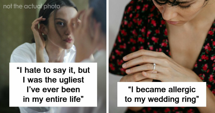 “I Was Literally Allergic To Him”: 71 Times People’s Bodies Literally Said “No” Before Their Hearts Did