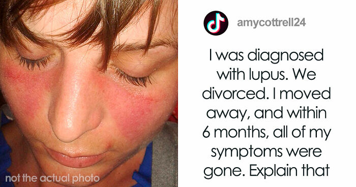 “I Was Literally Allergic To Him”: 71 Times People’s Bodies Literally Said “No” Before Their Hearts Did