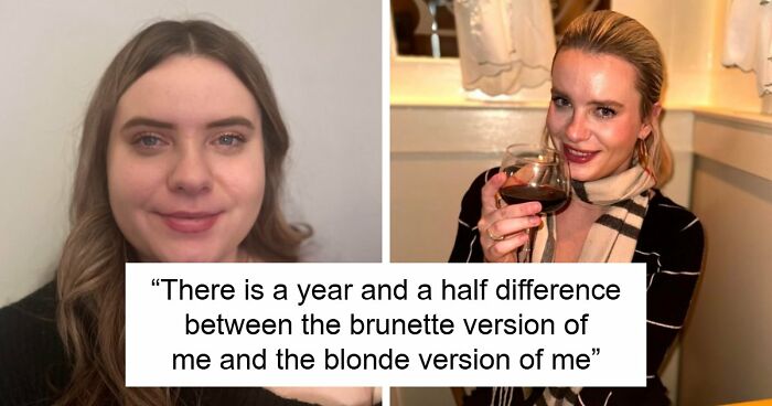 Woman Shows Her Crazy Transformation, People Can’t Believe It: “Lip Fillers, Botox, Weight Loss”