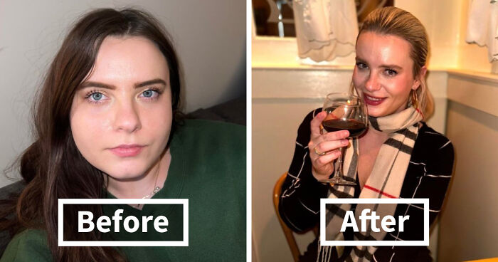 Woman Shows Her Crazy Transformation, People Can’t Believe It: “Lip Fillers, Botox, Weight Loss”