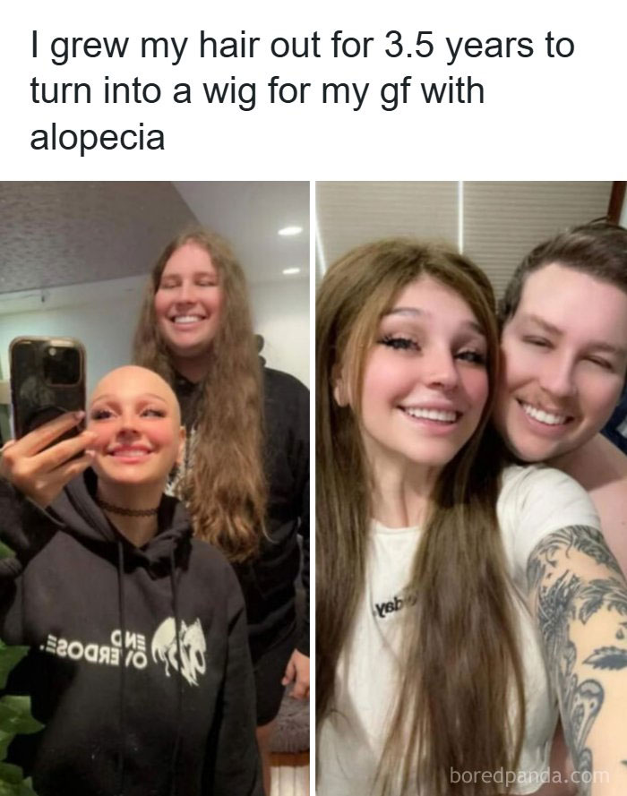 Man grows hair for 3.5 years to make wig for girlfriend with alopecia