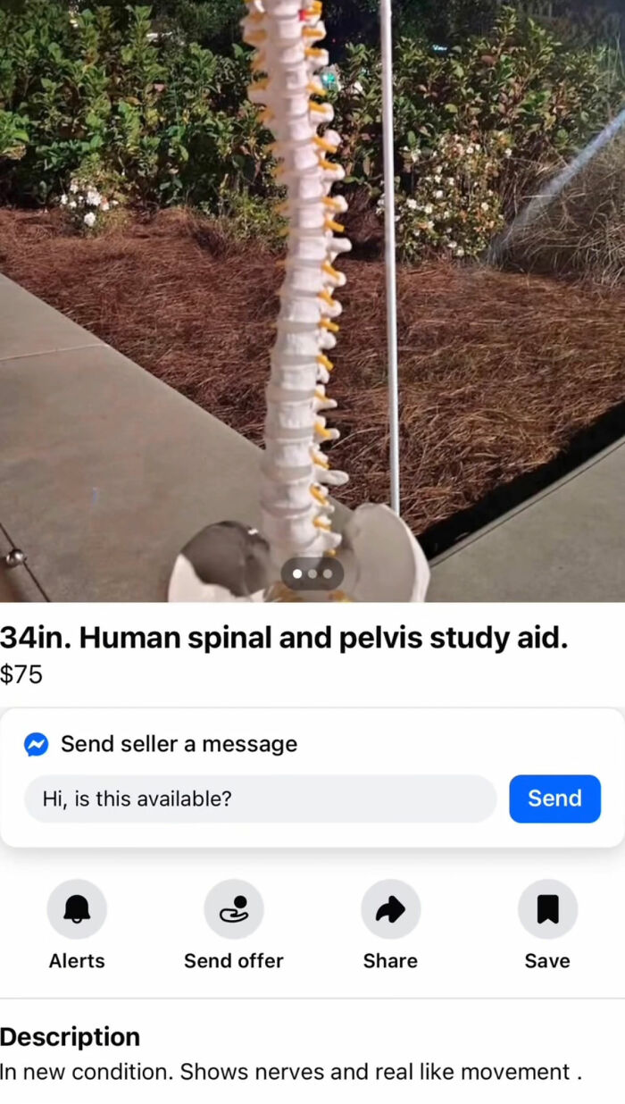 34 inch human spinal and pelvis study aid model outdoors