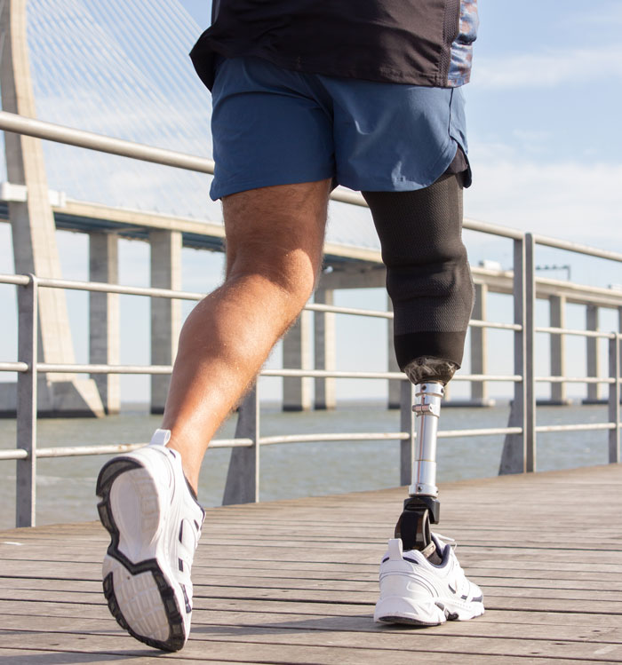 Close-up of runner with prosthetic leg jogging on bridge
