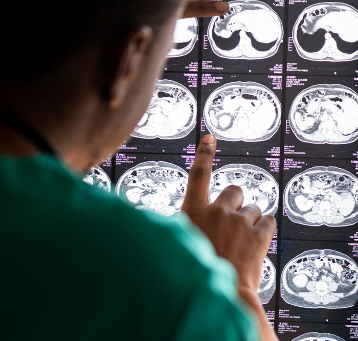 Doctor examining medical scans for diagnosis anxiety-inducing truths