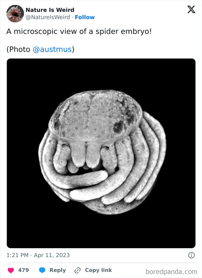 Microscopic black and white image of a spider embryo highlighting nature biology.