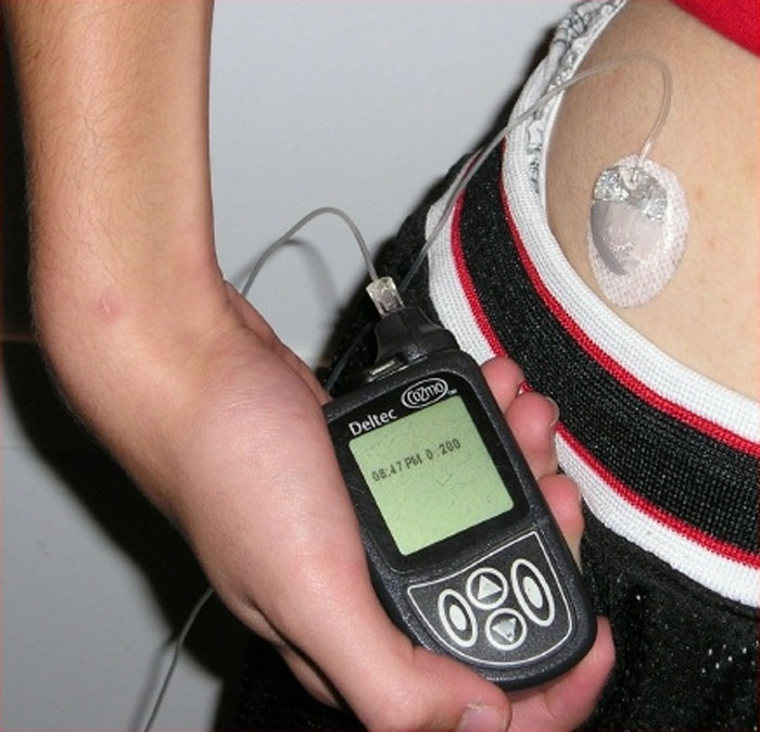 Give My Child Your Insulin Pump!