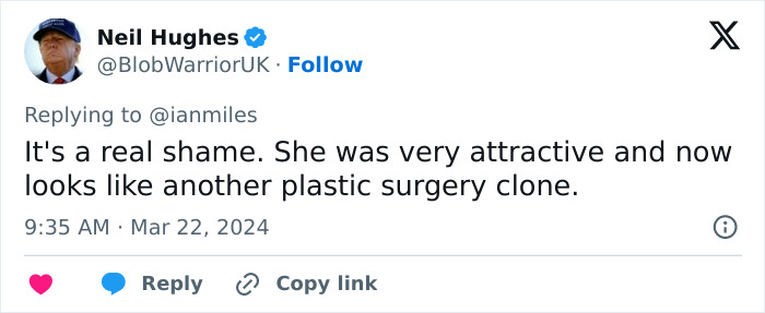 Scrutiny Over Megan Fox&rsquo;s Past Appearance In Ultra Revealing Dress As Many Slam Plastic Surgery