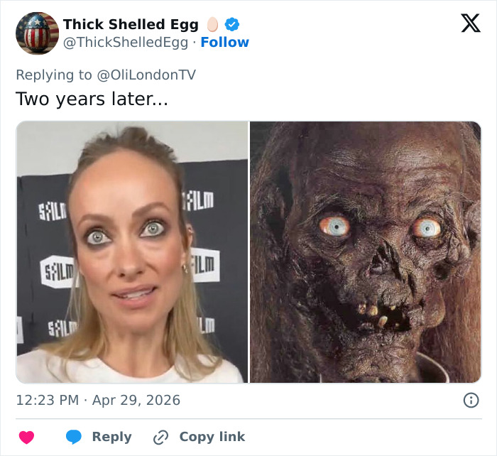 Doctors Suggest Cause Of Olivia Wilde's Recent Transformation After She Was Compared To Gollum