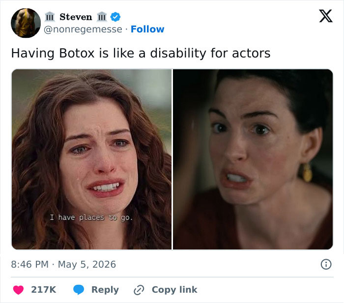 Anne Hathaway's botox scenes, comparing a crying scene to one with a stiff expression from 'The Odyssey.'