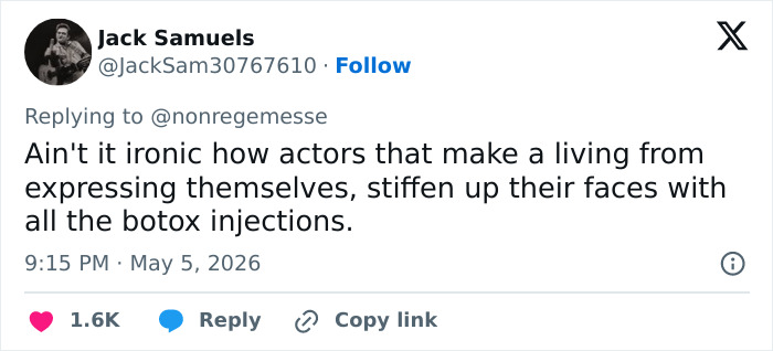 A tweet from Jack Samuels mocking actors for using botox injections, hindering their acting and expression.