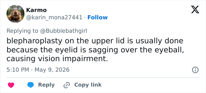 Explanation of blepharoplasty and vision impairment