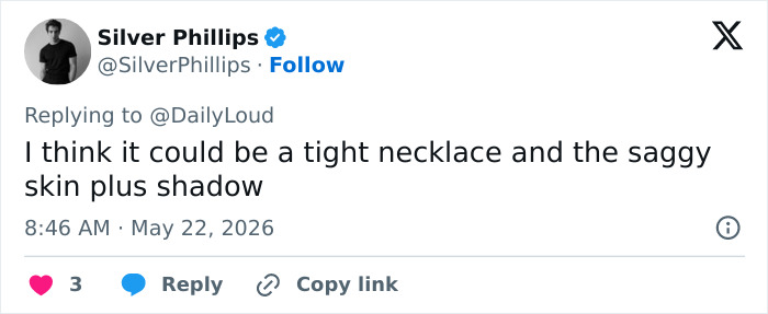 Tweet suggesting necklace and shadow cause visual oddity in Navy Vice Admiral appearance Tweet suggesting necklace and shadow cause visual oddity in Navy Vice Admiral appearance