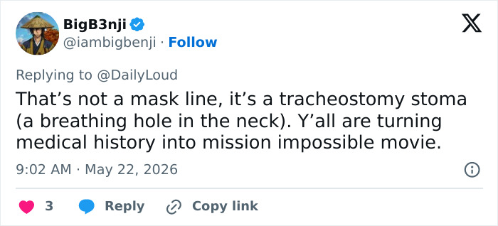 Tweet explaining tracheostomy stoma mistaken for mask in Navy Vice Admiral Fox News appearance Tweet explaining tracheostomy stoma mistaken for mask in Navy Vice Admiral Fox News appearance