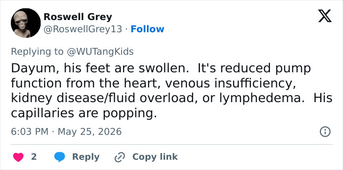 Social media discussion on swollen feet and possible heart or kidney issues Social media discussion on swollen feet and possible heart or kidney issues