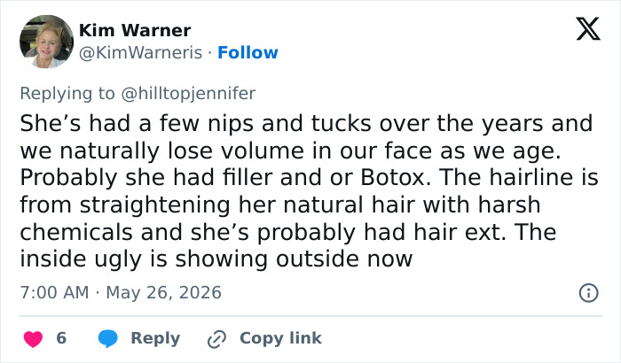 Comment suggesting Meghan Markle had filler, Botox, and hair treatments over the years