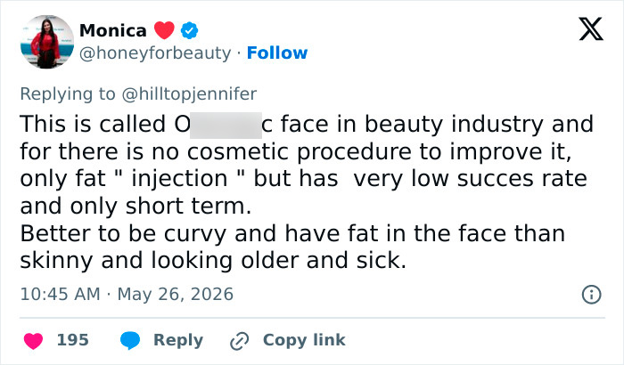 Comment about cosmetic procedures and fat injection related to Meghan Markle's face