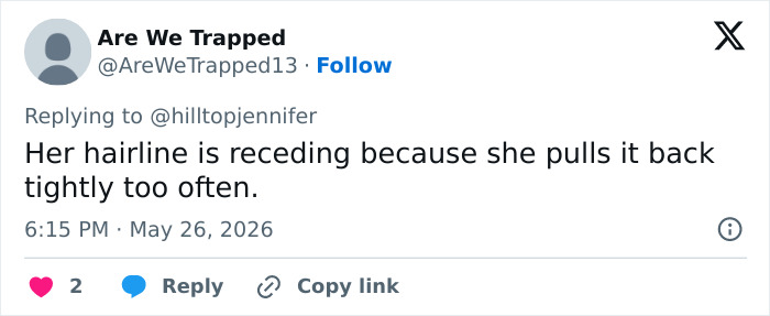 Tweet about Meghan Markle's receding hairline due to pulling hair back tightly