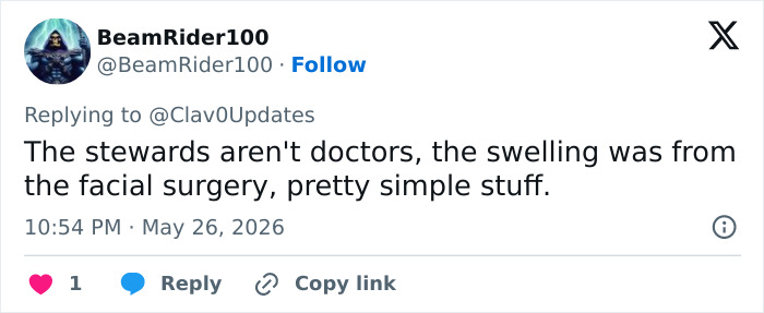 Tweet explaining swelling due to facial surgery, not steward care