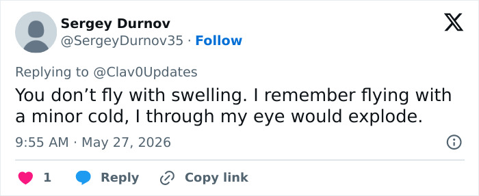 Comment on flying with swelling related to looksmaxxer plastic surgery issue