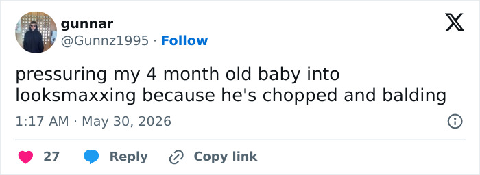 Tweet about pressuring a 4 month old baby into looksmaxxing due to hair loss