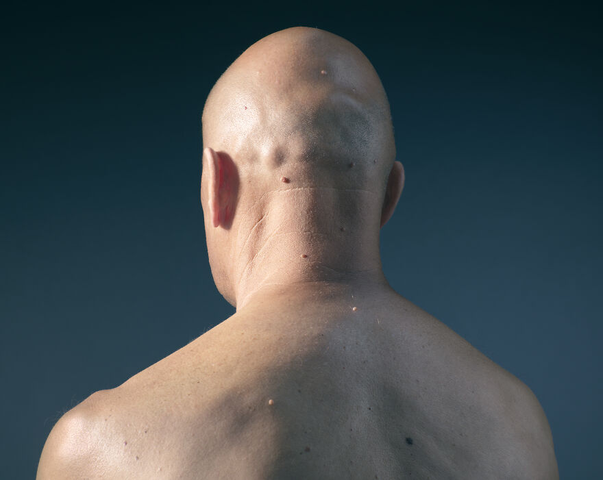 Why Do We Get Goosebumps? The Fascinating Science Behind Your Skin's Reflex