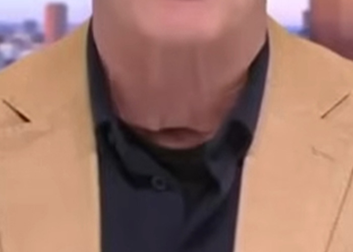 Zoomed-in view of retired Navy Vice Admiral's neck on Fox News Zoomed-in view of retired Navy Vice Admiral's neck on Fox News