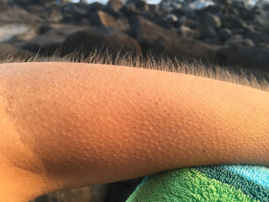 Why Do We Get Goosebumps? The Fascinating Science Behind Your Skin's Reflex