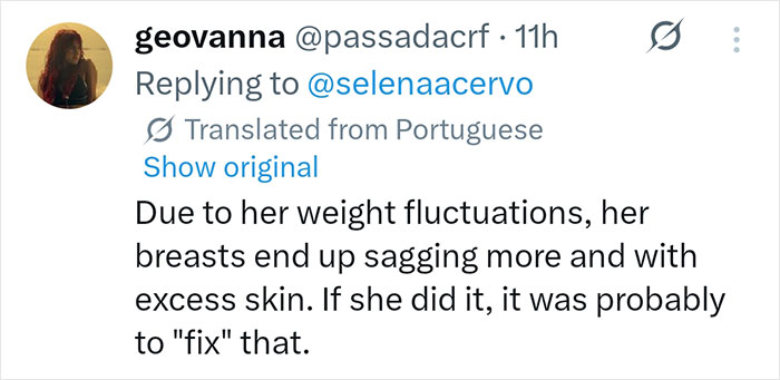 Nova foto de Selena Gomez revela cirurgia plástica surpreendente, afirmam fãs