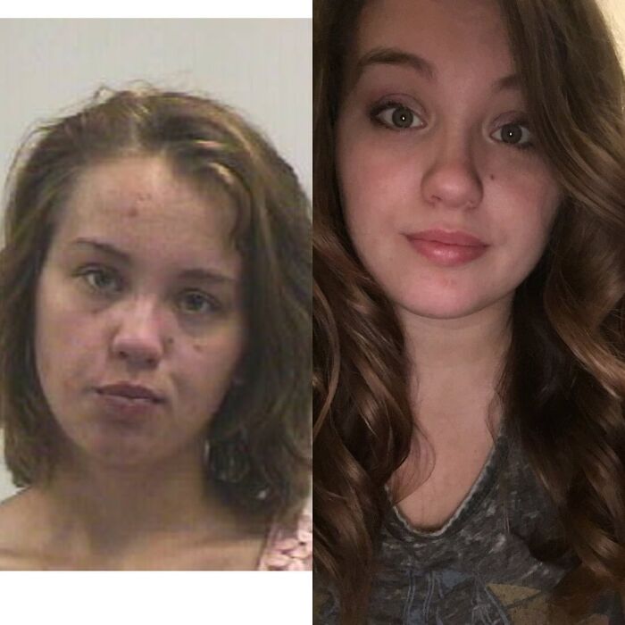 Before and after photos of woman showing impressive recovery and transformation