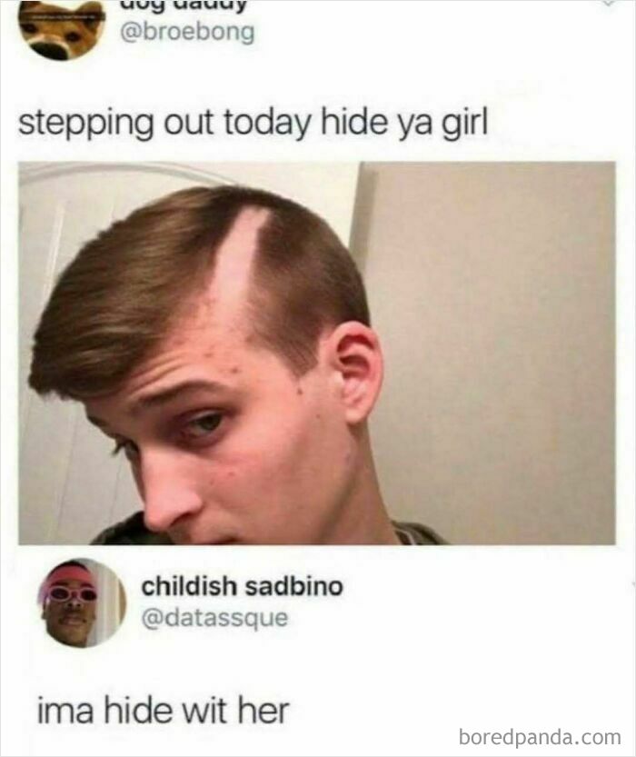 A man with a pale stripe where his hair was parted. A second user comments with a reaction image. This is a rare burn.