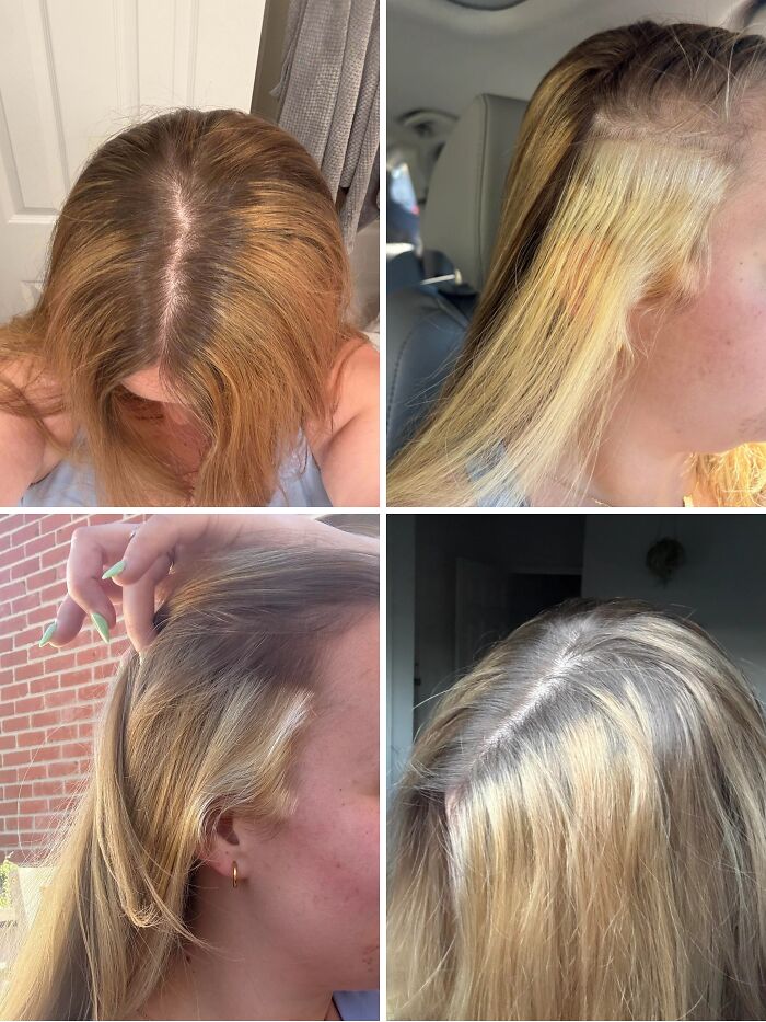 A four-panel image showing a hair coloring beauty disaster. Bleached sections contrast with a reddish-brown base and dark roots.